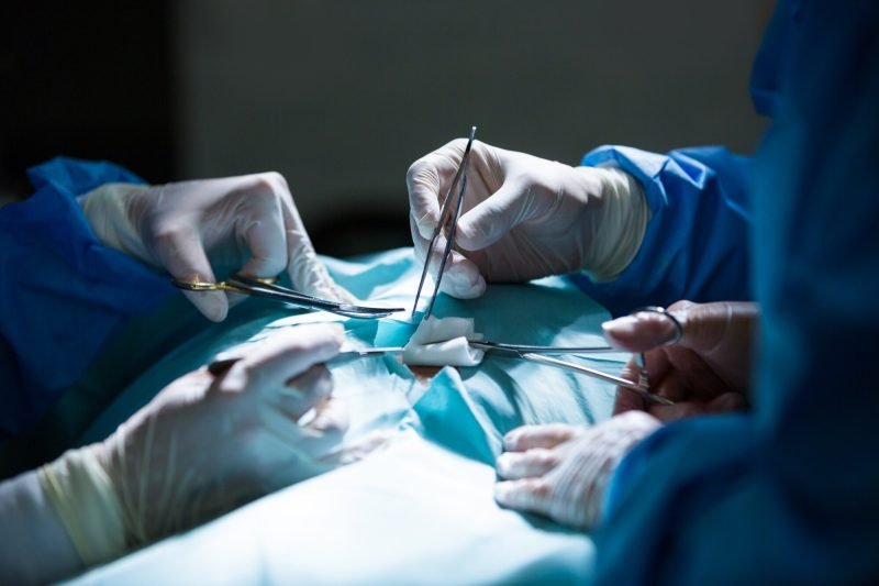 Laparoscopic Surgery: Benefits, Risks, and Recovery